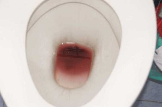 spotting on men when they are excited